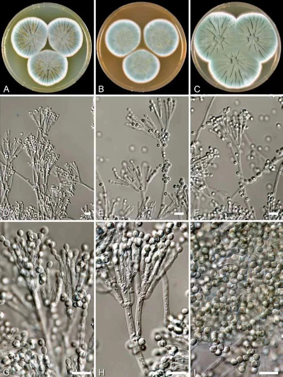 Penicillium rubens CBS 205.57 (Fleming’s original penicillin-producer). A–C. Colonies 7 d old 25 °C. A. CYA. B. MEA. C. YES. D–H. Condiophor